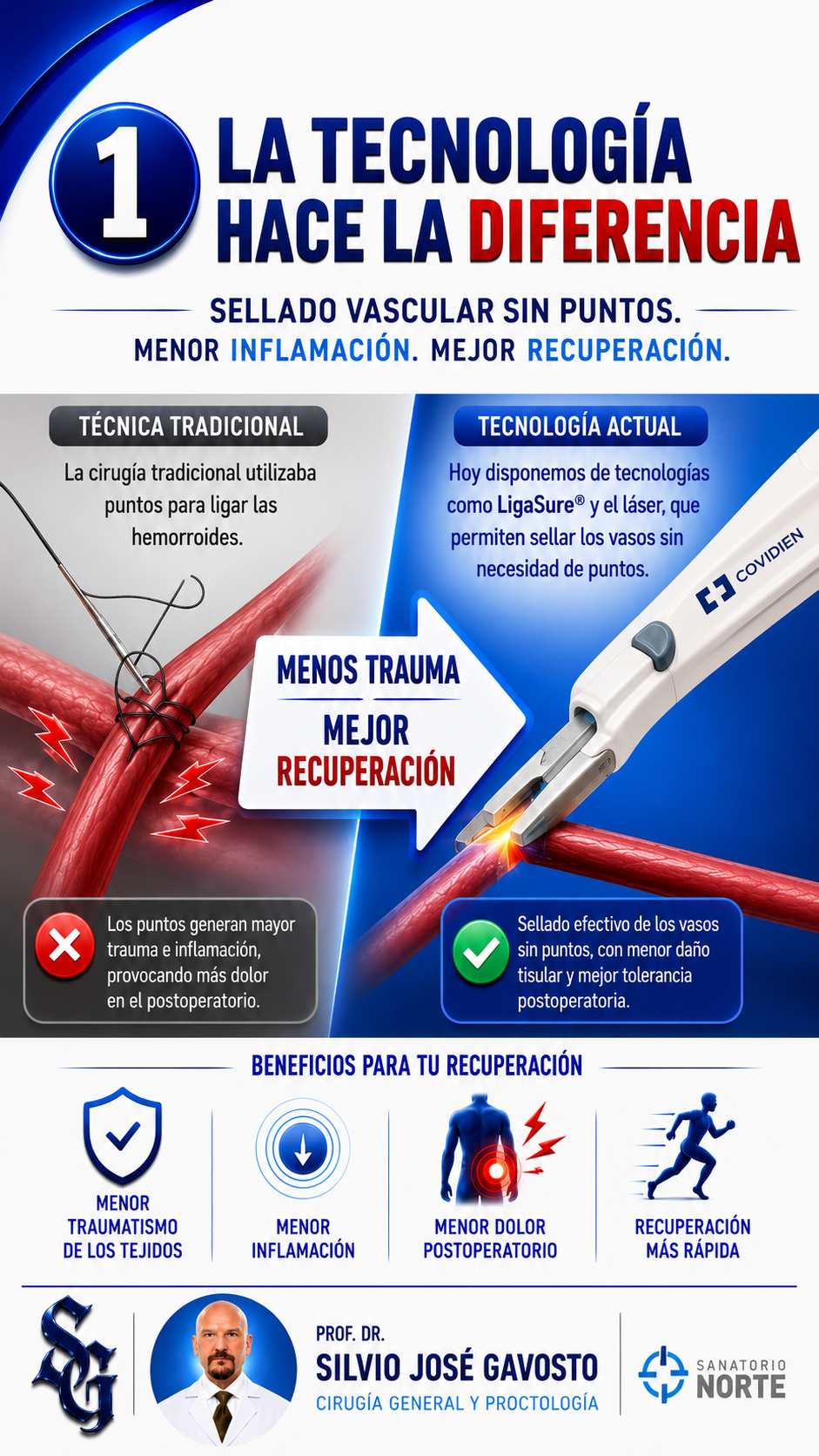 Tecnología quirúrgica moderna LigaSure para cirugía de hemorroides — Prof. Dr. Silvio Gavosto, Rosario
